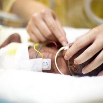 Photo d’illustration nouveau-née prématurée sous assistance respiratoire dans un service de néonatologie. Photo : Phanie Voisin via AFP
